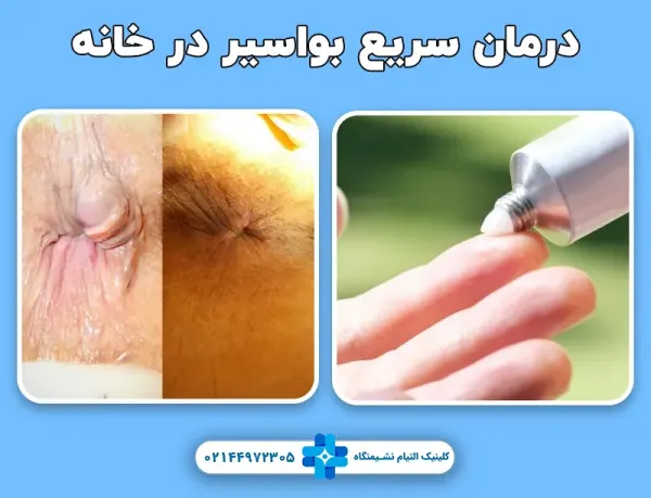  چه دارویی برای عفونت بواسیر خوب است؟