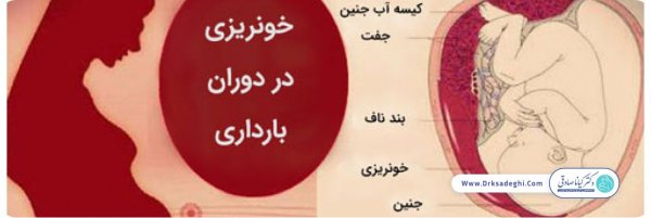  عکس لخته خون در بارداری