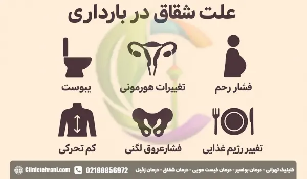  درمان خانگی شقاق در بارداری