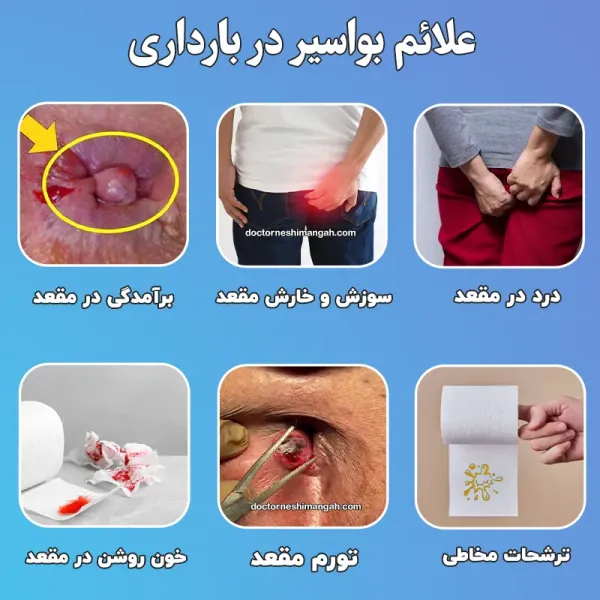  لیزر شقاق در بارداری