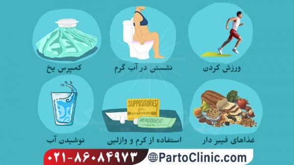  لیزر هموروئید در بارداری