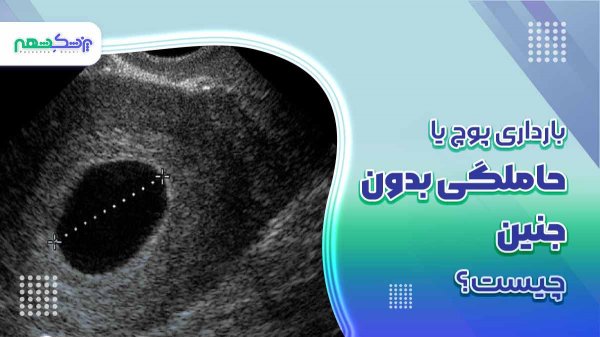 جلوگیری از بارداری پوچ با طب سنتی