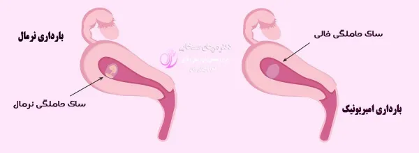  جلوگیری از بارداری پوچ با طب سنتی