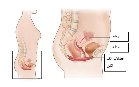  بیوفیدبک مقعدی چیست؟