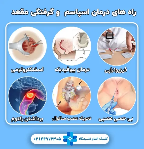 بیوفیدبک مقعدی چیست؟