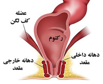  بیوفیدبک مقعدی چیست؟