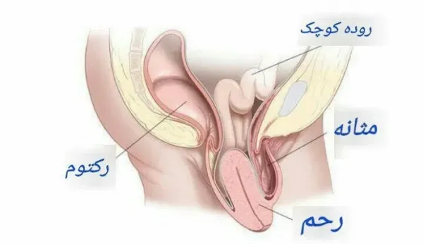  عوارض فیزیوتراپی رحم