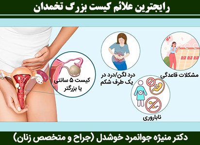  هزینه عمل کیست تخمدان با لیزر