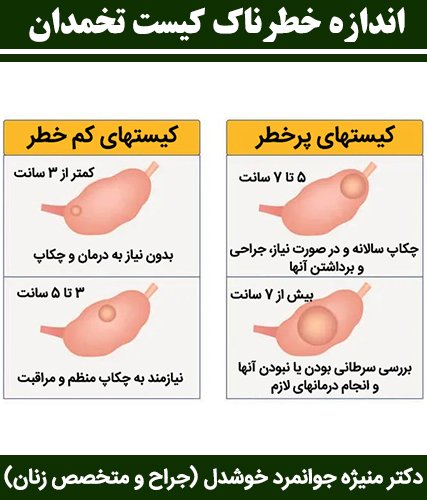  مراقبت های بعد از جراحی باز کیست تخمدان