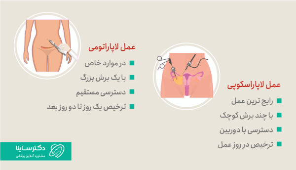  مراقبت های بعد از جراحی باز کیست تخمدان