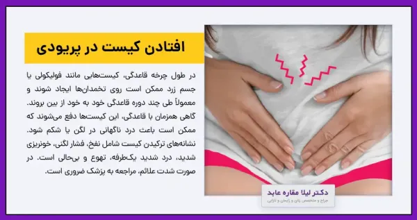  مراقبت های بعد از جراحی باز کیست تخمدان