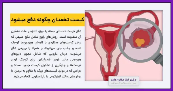  عکس کیست درموئید
