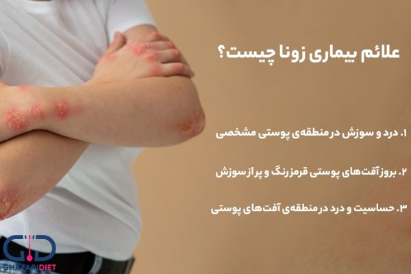  عکس بیماری زونا در بزرگسالان