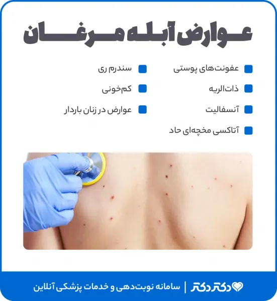  آیا زونا برای جنین خطرناک است؟