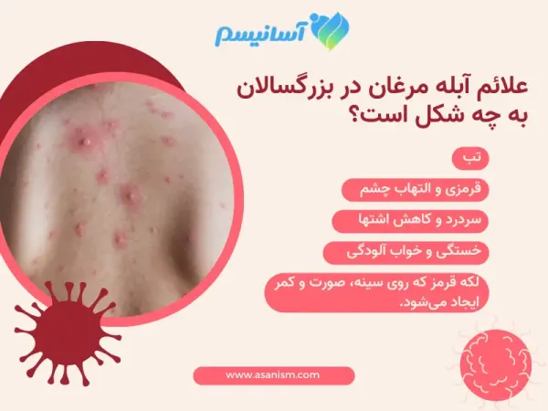  آیا زونا برای جنین خطرناک است؟