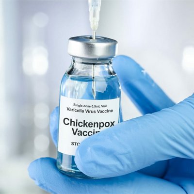  قیمت واکسن آبله مرغان 1404