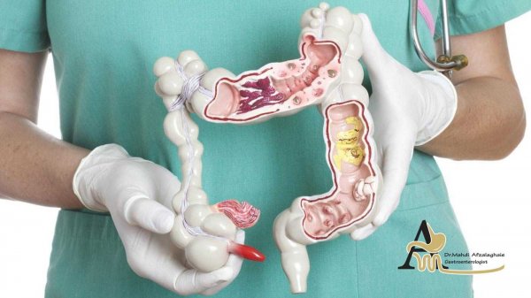  ریکاوری بعد از کولونوسکوپی