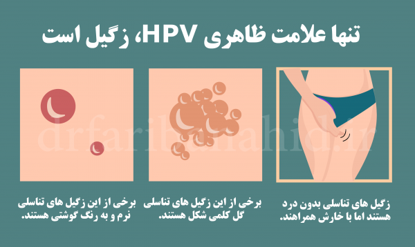  آیا بعد از درمان زگیل تناسلی میتوان بچه دار شد؟