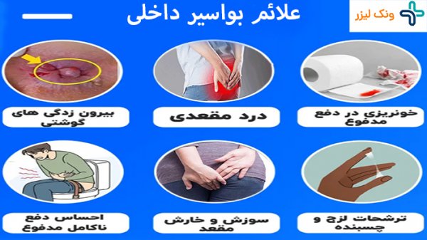  عکس سرطان مقعدی