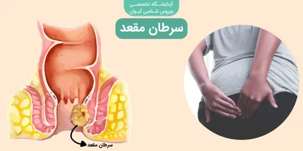  عکس سرطان مقعدی