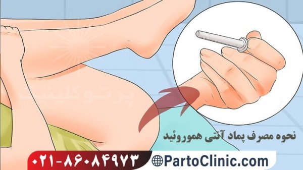  نظرات درباره پماد رکتول