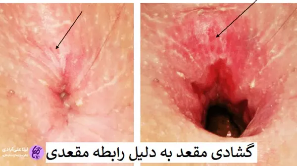  سوال و جواب زناشویی جدید انلاین رایگان