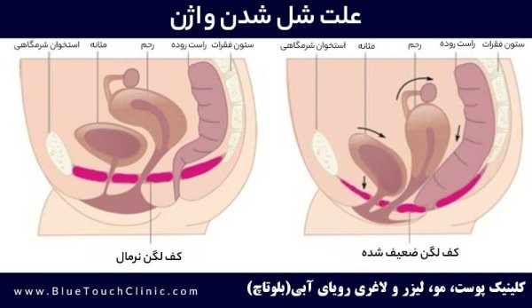  عوارض رابطه طولانی مدت
