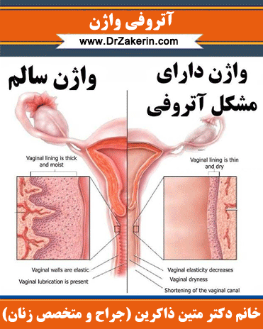  آیا اولین دخول درد دارد + درد اولین رابطه چقدر است؟