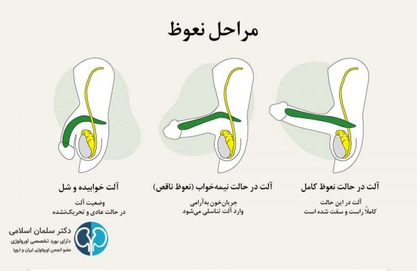  بعد از انزال چه اتفاقی در بدن می افتد؟