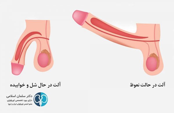 چگونه نعوظ قوی داشته باشیم؟