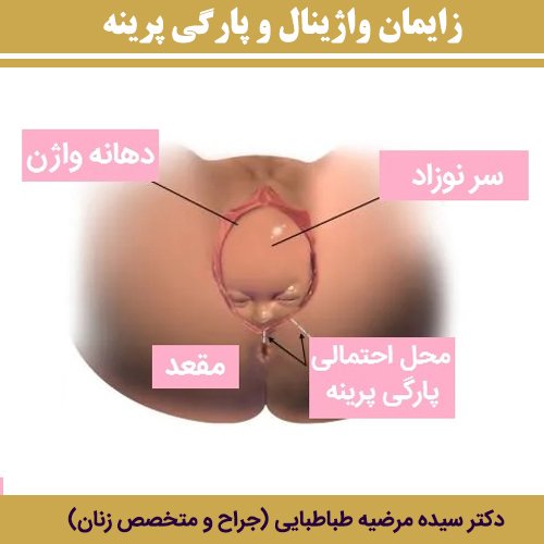  واژن دقیقا کجاست + ناحیه ژنیتال کجاست؟