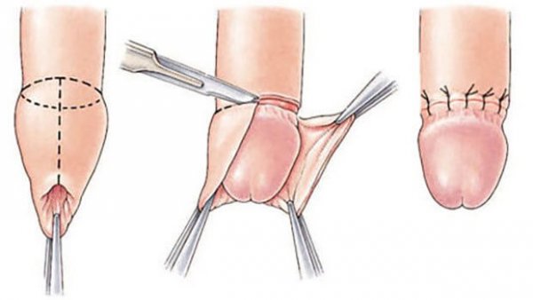  پنیس در مردان کجاست + عورت مرد کجاست + عکس واقعی