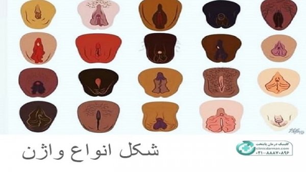 عکس دهانه واژن نرمال