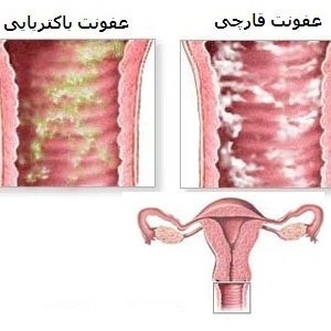  عکس دهانه واژن نرمال