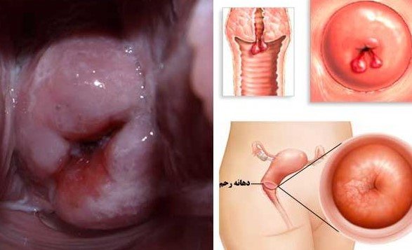  عکس دهانه واژن نرمال