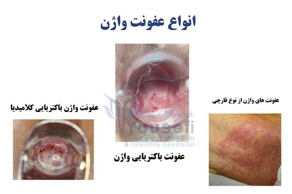  عکس دهانه واژن نرمال