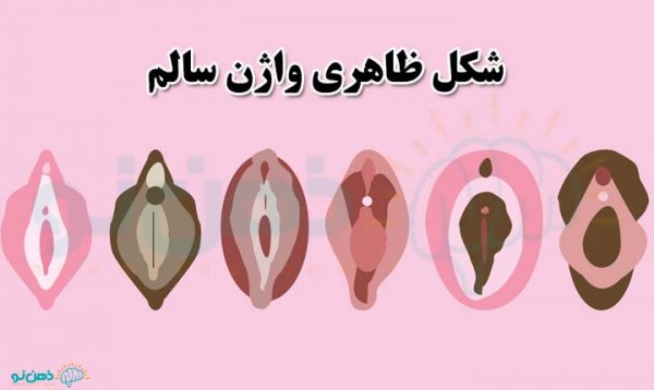  عکس دهانه واژن نرمال