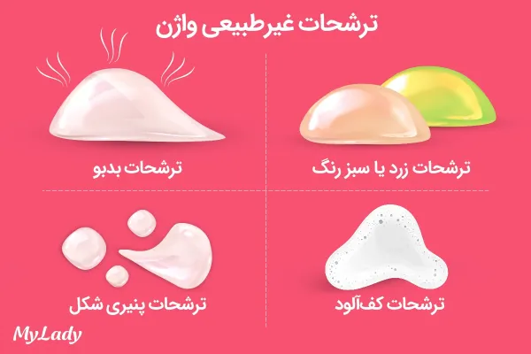  رنگ عفونت واژن