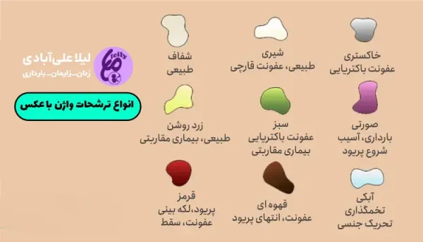  رنگ عفونت واژن