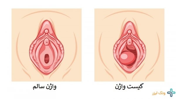  عکس واژن طبیعی و نرمال