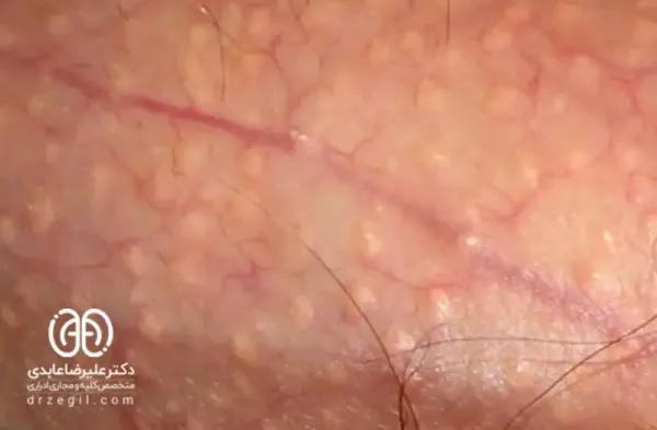  عکس واژن طبیعی و نرمال