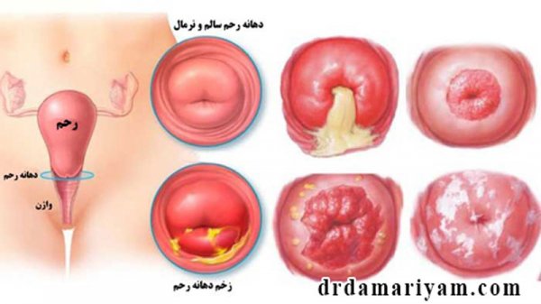  عکس رحم سالم و ناسالم