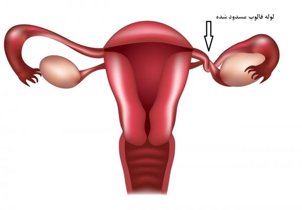  عکس رحم سالم و ناسالم