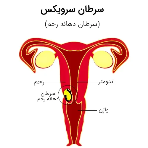  عکس رحم سالم و ناسالم