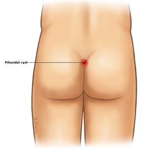 کفل زن کجاست عکس واقعی