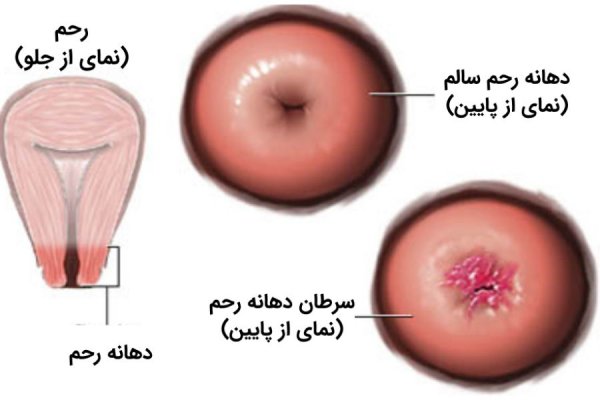  کفل زن کجاست عکس واقعی