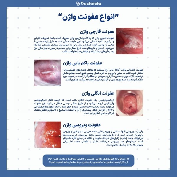  عکس بیکینی واقعی