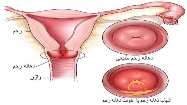  عکس بیکینی واقعی