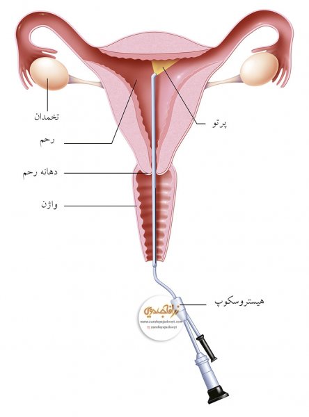  عکس بیکینی واقعی