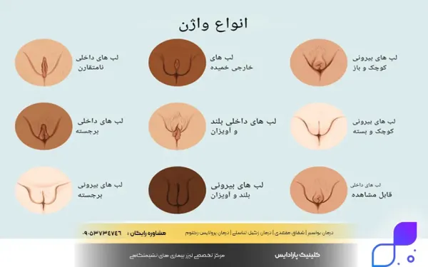  تشخیص رنگ واژن از چهره